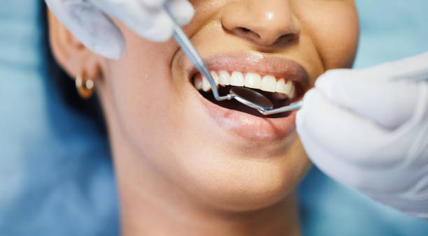 Best Emergency Wisdom Teeth Removal in Robersonville, NC