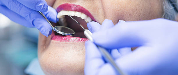 Best Emergency Dental Care for Broken or Chipped Teeth in Robersonville, NC